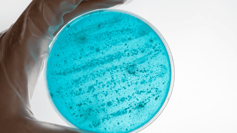 Gloved hand displaying a bacteria filter in a petri dish.