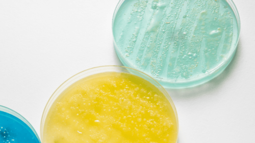 Top view of three Petri dishes showing various stages of microbial growth on GVS Malaysia microbial count plates, featuring distinct blue and yellow cultures against a white background