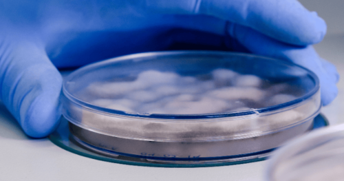 Gloved hand holding a microbial count plate, used for precise bacterial and fungal analysis in laboratories.